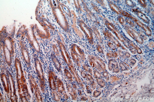 Calpain 9 Antibody in Immunohistochemistry (Paraffin) (IHC (P))