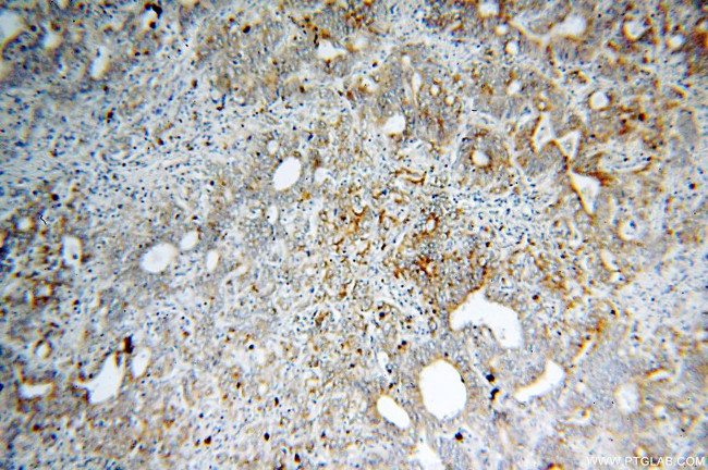 Calpain 9 Antibody in Immunohistochemistry (Paraffin) (IHC (P))