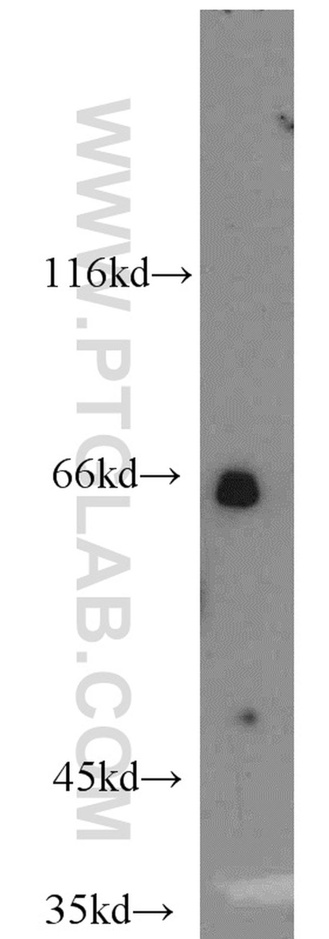 Calpain 9 Antibody in Western Blot (WB)