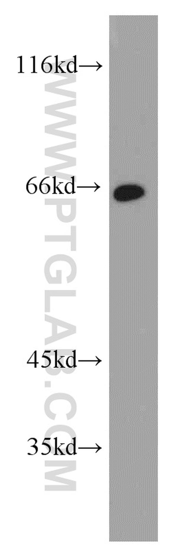 Calpain 9 Antibody in Western Blot (WB)