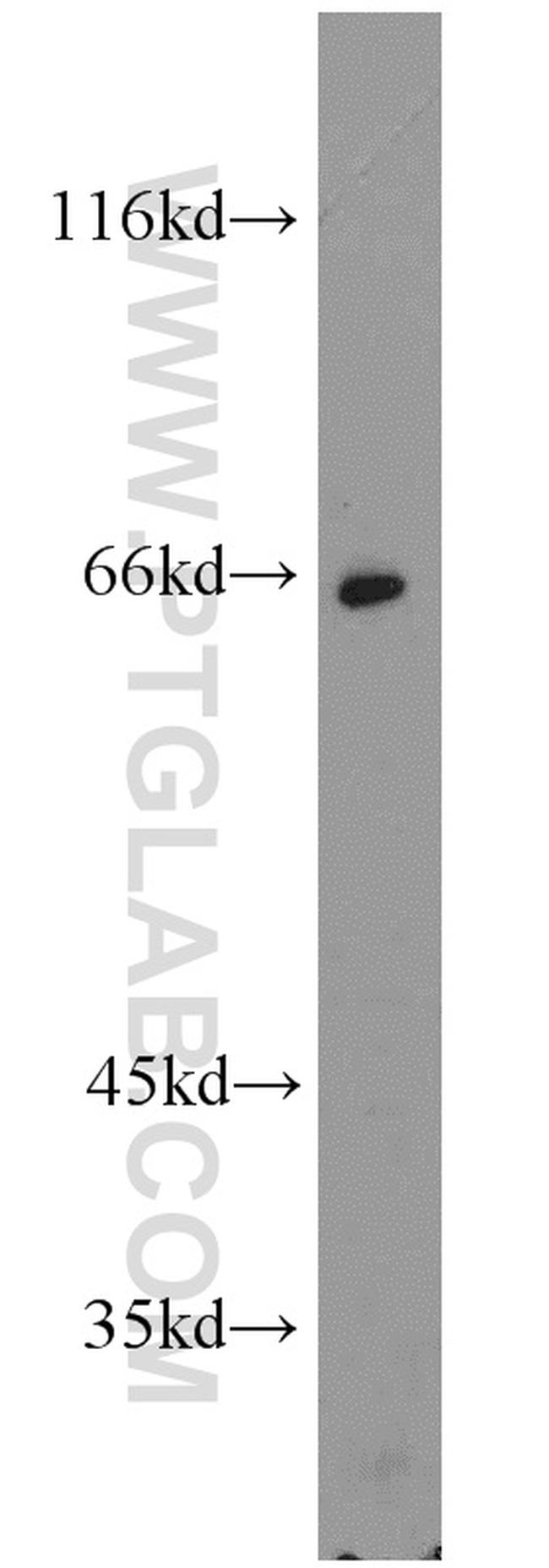 Calpain 9 Antibody in Western Blot (WB)