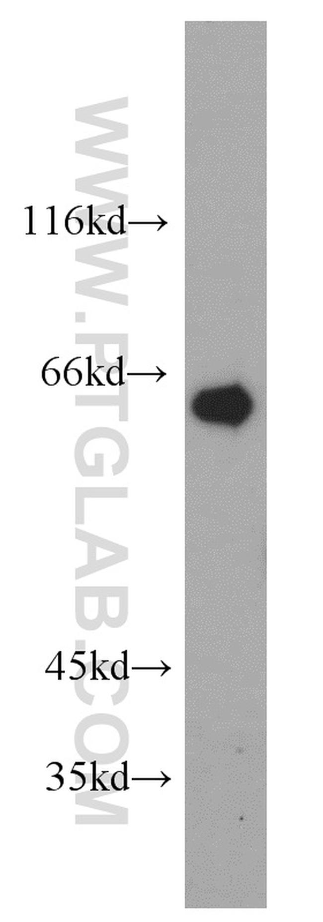 Calpain 9 Antibody in Western Blot (WB)