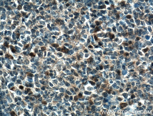 WDFY4 Antibody in Immunohistochemistry (Paraffin) (IHC (P))