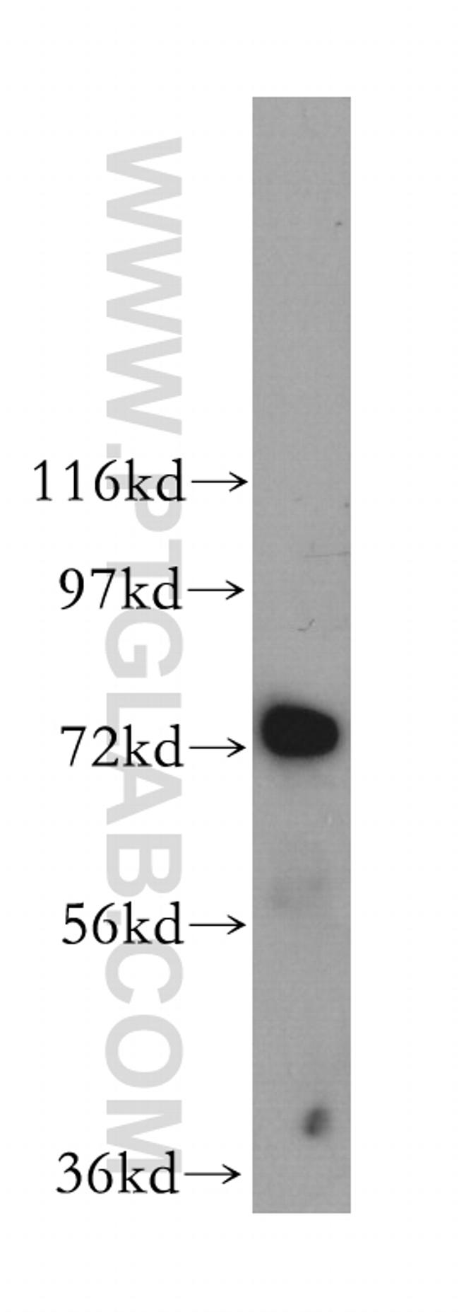 WDFY4 Antibody in Western Blot (WB)