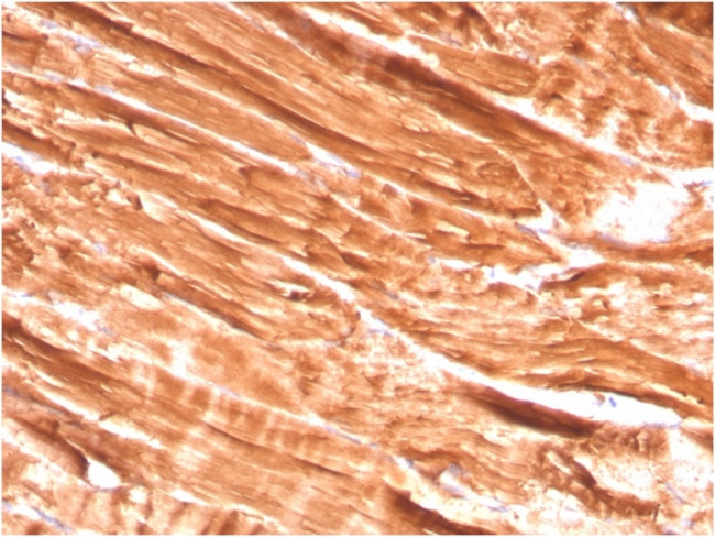 Dystrophin (DMD) Antibody in Immunohistochemistry (Paraffin) (IHC (P))