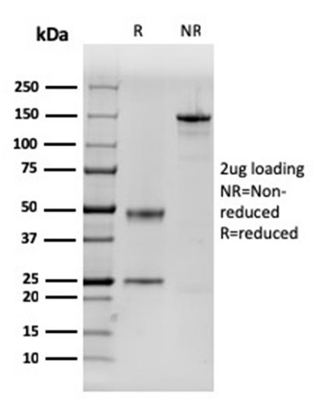 Dystrophin (DMD) Antibody in SDS-PAGE (SDS-PAGE)