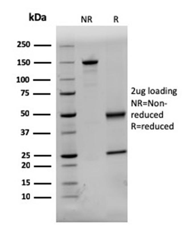 Dystrophin (DMD) Antibody in SDS-PAGE (SDS-PAGE)