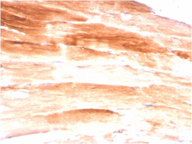 Dystrophin (DMD) (Marker of Duchenne and Becker Muscular Dystrophy) Antibody in Immunohistochemistry (Paraffin) (IHC (P))