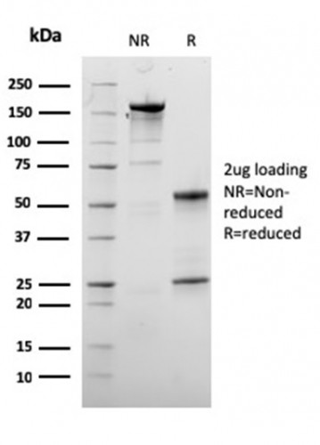 Dystrophin (DMD) (Marker of Duchenne and Becker Muscular Dystrophy) Antibody in SDS-PAGE (SDS-PAGE)