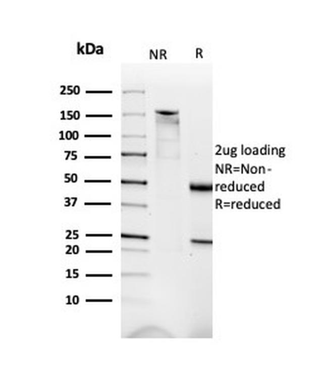 Dystrophin (DMD) (Marker of Duchenne and Becker Muscular Dystrophy) Antibody in Immunoelectrophoresis (IE)