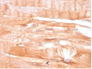 Dystrophin (DMD) (Marker of Duchenne and Becker Muscular Dystrophy) Antibody in Immunohistochemistry (Paraffin) (IHC (P))