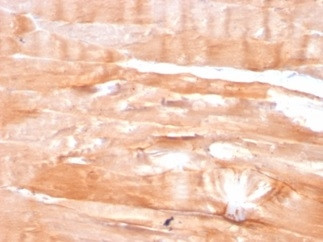 Dystrophin (DMD) (Marker of Duchenne and Becker Muscular Dystrophy) Antibody in Immunohistochemistry (Paraffin) (IHC (P))