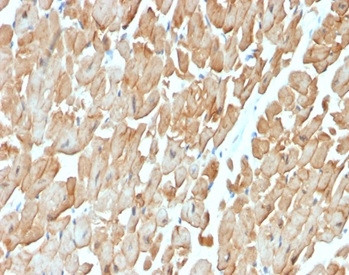 Dystrophin (DMD) (Marker of Duchenne and Becker Muscular Dystrophy) Antibody in Immunohistochemistry (Paraffin) (IHC (P))