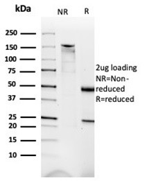 Dystrophin (DMD) (Marker of Duchenne and Becker Muscular Dystrophy) Antibody in SDS-PAGE (SDS-PAGE)