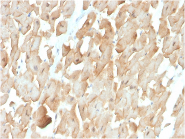 Dystrophin (DMD) (Marker of Duchenne and Becker Muscular Dystrophy) Antibody in Immunohistochemistry (Paraffin) (IHC (P))