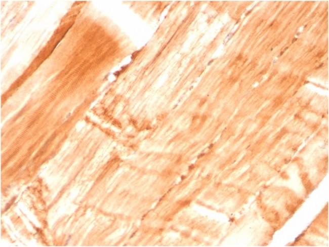 Dystrophin (DMD) (Marker of Duchenne and Becker Muscular Dystrophy) Antibody in Immunohistochemistry (Paraffin) (IHC (P))