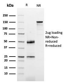 Dystrophin (DMD) (Marker of Duchenne and Becker Muscular Dystrophy) Antibody in SDS-PAGE (SDS-PAGE)