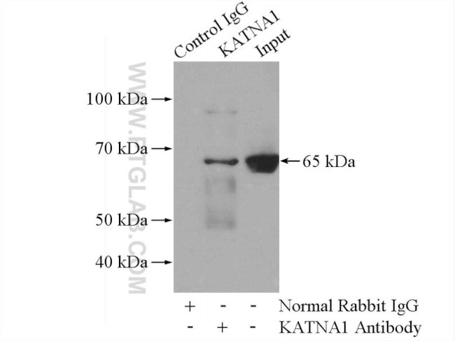 KATNA1 Antibody in Immunoprecipitation (IP)