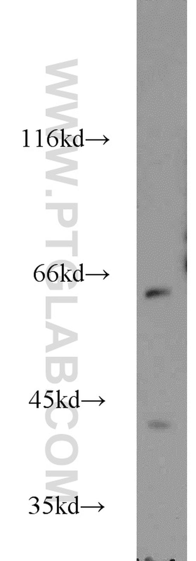 KATNA1 Antibody in Western Blot (WB)