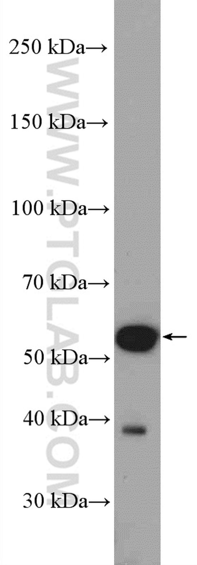 KATNA1 Antibody in Western Blot (WB)