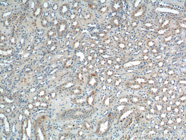 Sur-8 Antibody in Immunohistochemistry (Paraffin) (IHC (P))