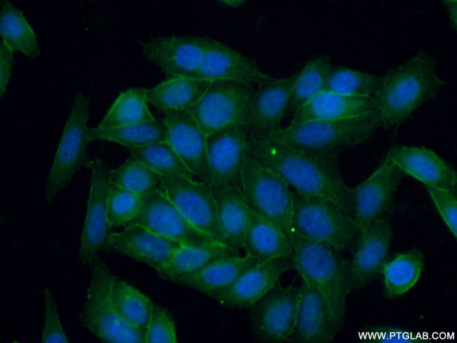 CD146/MCAM Antibody in Immunocytochemistry (ICC/IF)