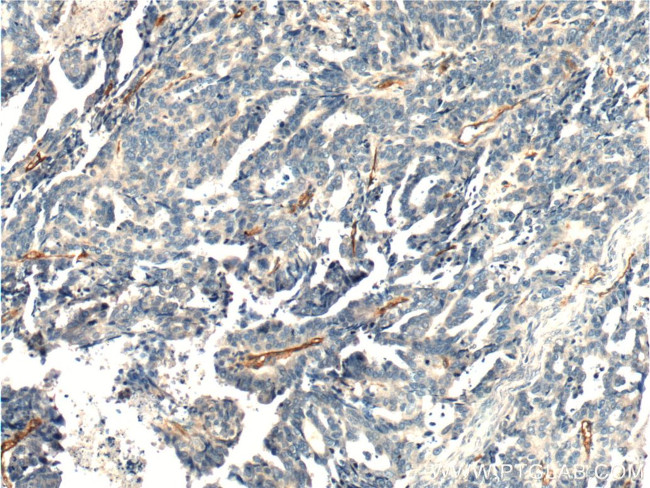 CD146/MCAM Antibody in Immunohistochemistry (Paraffin) (IHC (P))