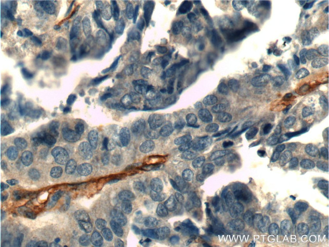 CD146/MCAM Antibody in Immunohistochemistry (Paraffin) (IHC (P))