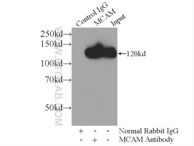 CD146/MCAM Antibody in Immunoprecipitation (IP)