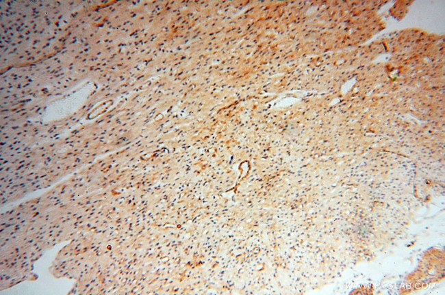 CD146/MCAM Antibody in Immunohistochemistry (Paraffin) (IHC (P))