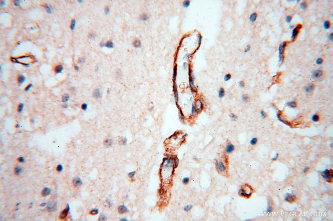 CD146/MCAM Antibody in Immunohistochemistry (Paraffin) (IHC (P))