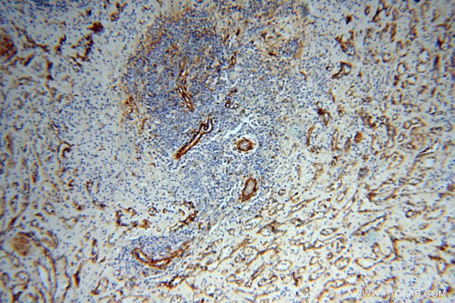 CD146/MCAM Antibody in Immunohistochemistry (Paraffin) (IHC (P))