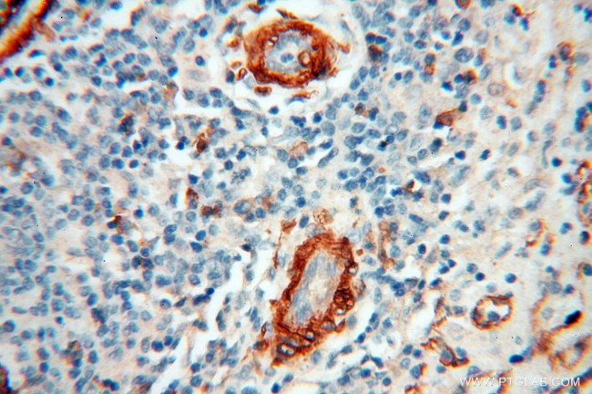 CD146/MCAM Antibody in Immunohistochemistry (Paraffin) (IHC (P))