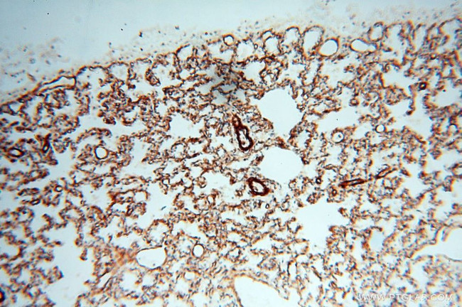 CD146/MCAM Antibody in Immunohistochemistry (Paraffin) (IHC (P))