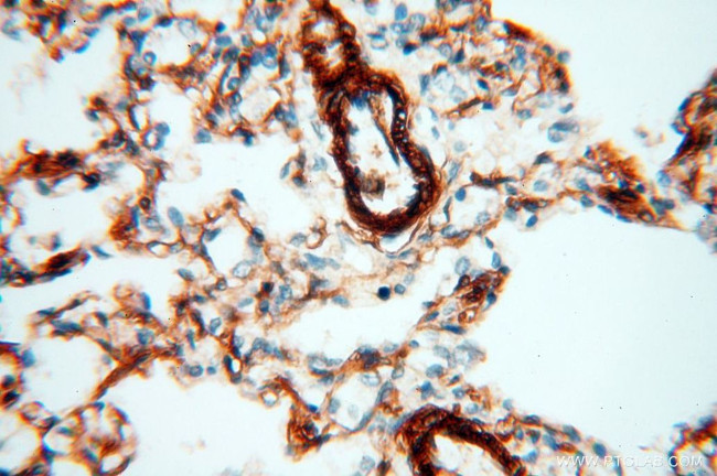 CD146/MCAM Antibody in Immunohistochemistry (Paraffin) (IHC (P))