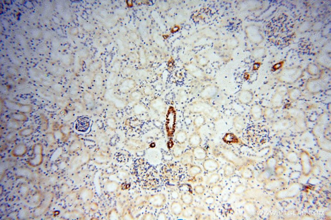 CD146/MCAM Antibody in Immunohistochemistry (Paraffin) (IHC (P))