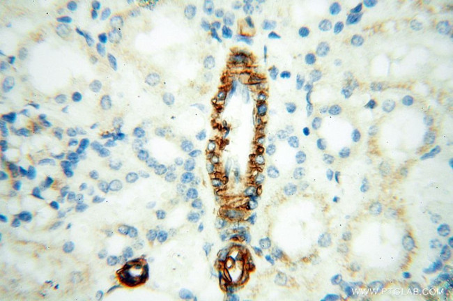 CD146/MCAM Antibody in Immunohistochemistry (Paraffin) (IHC (P))