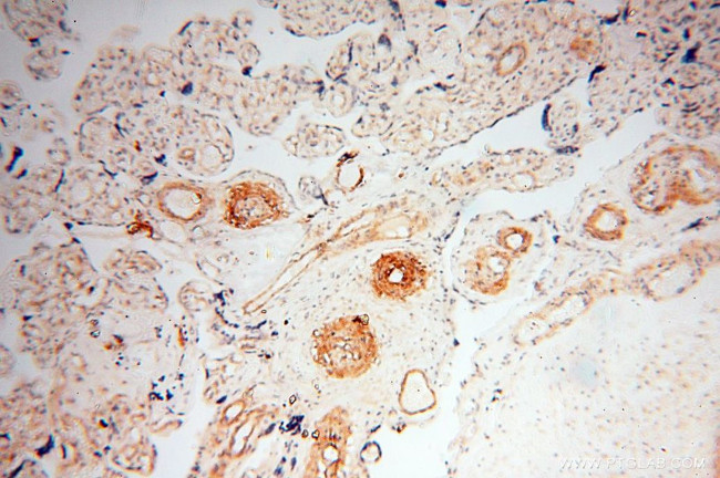 CD146/MCAM Antibody in Immunohistochemistry (Paraffin) (IHC (P))