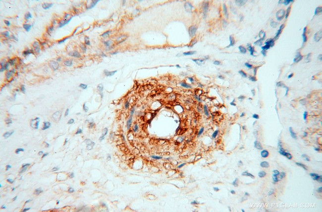 CD146/MCAM Antibody in Immunohistochemistry (Paraffin) (IHC (P))