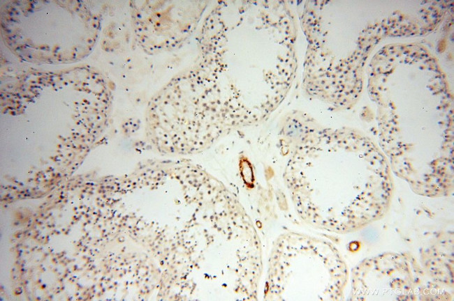 CD146/MCAM Antibody in Immunohistochemistry (Paraffin) (IHC (P))