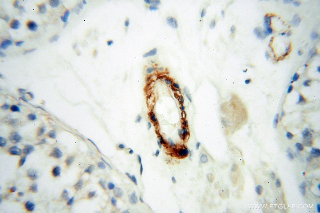 CD146/MCAM Antibody in Immunohistochemistry (Paraffin) (IHC (P))