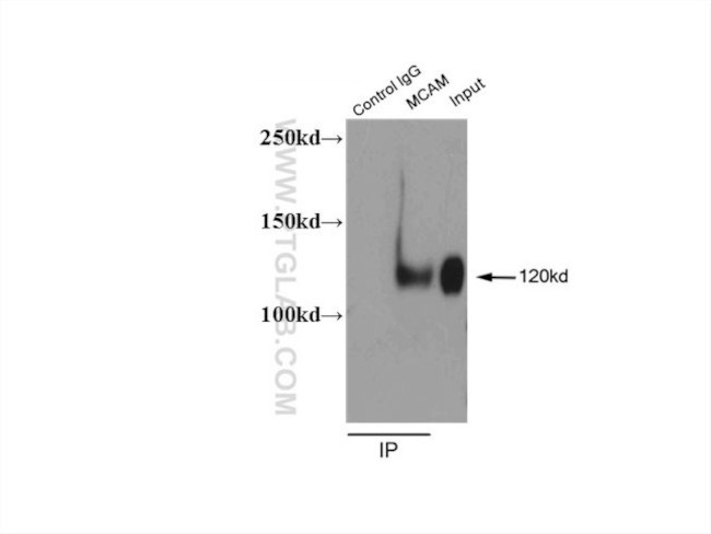 CD146/MCAM Antibody in Immunoprecipitation (IP)