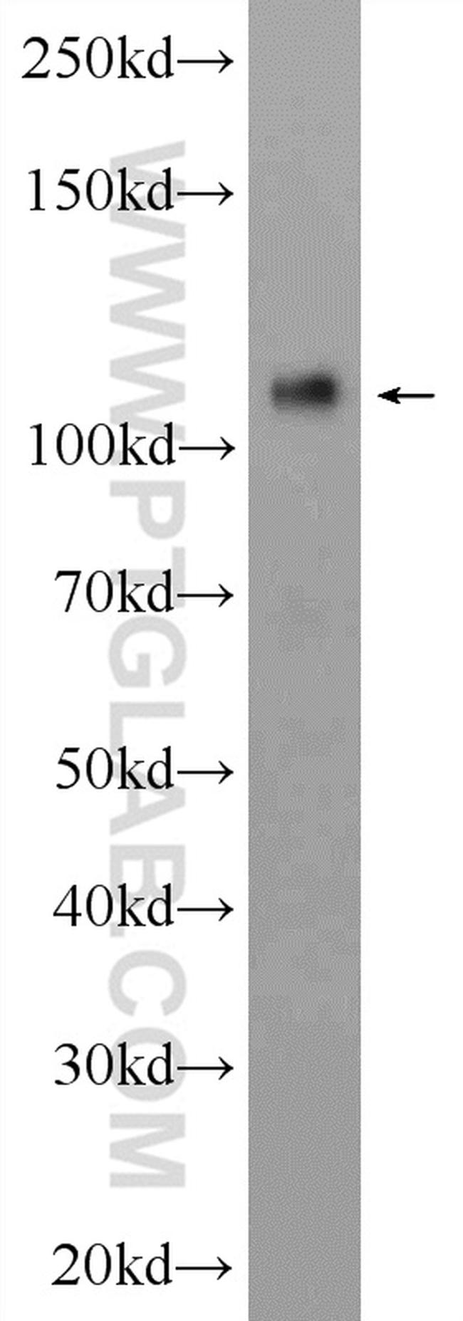 CD146/MCAM Antibody in Western Blot (WB)