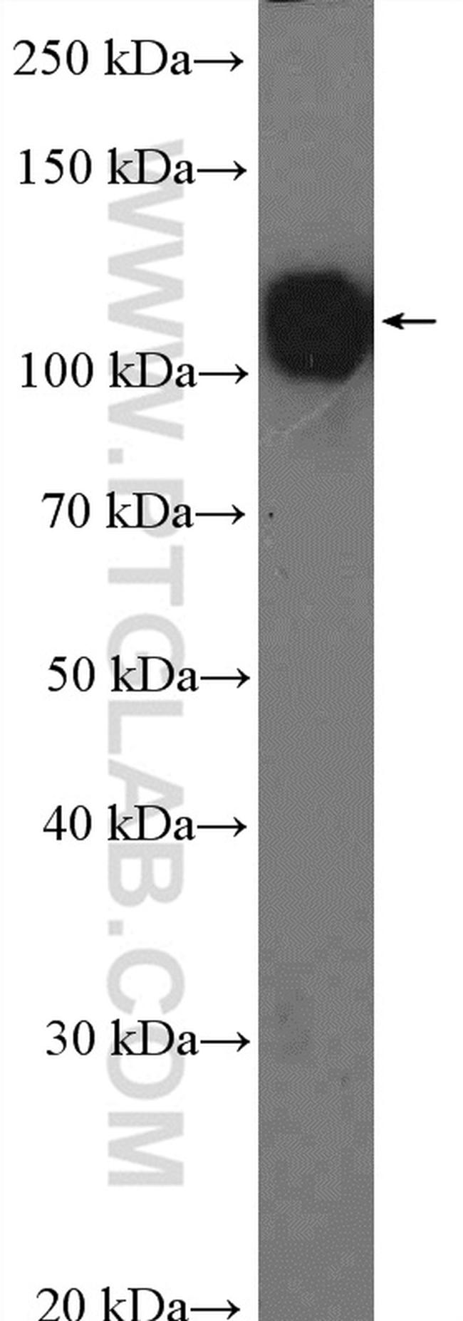 CD146/MCAM Antibody in Western Blot (WB)