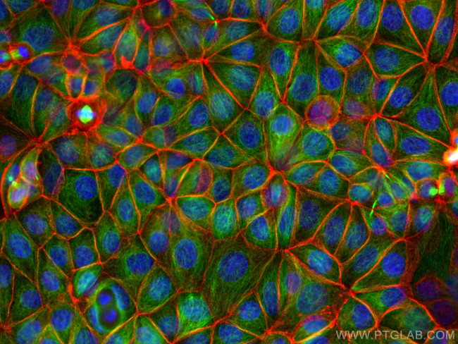 beta-Catenin Antibody in Immunocytochemistry (ICC/IF)