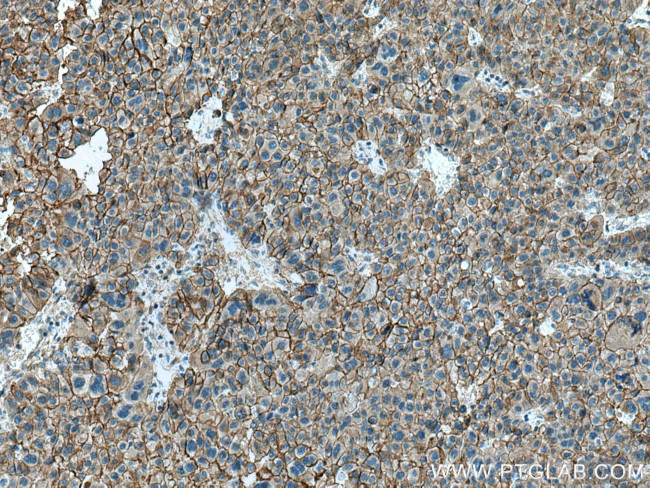 beta-Catenin Antibody in Immunohistochemistry (Paraffin) (IHC (P))