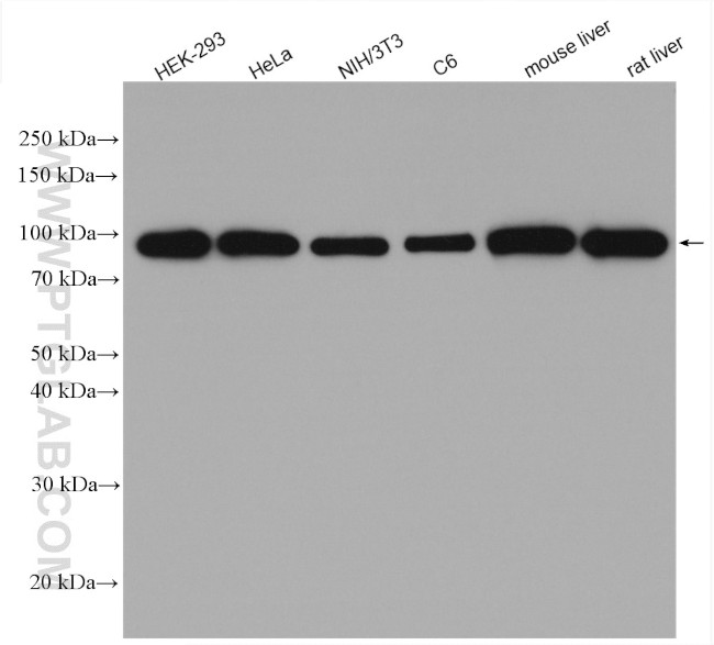 beta-Catenin Antibody in Western Blot (WB)