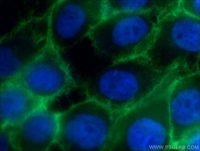 beta-Catenin Antibody in Immunocytochemistry (ICC/IF)