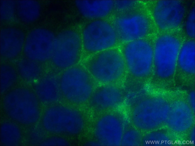 beta-Catenin Antibody in Immunocytochemistry (ICC/IF)