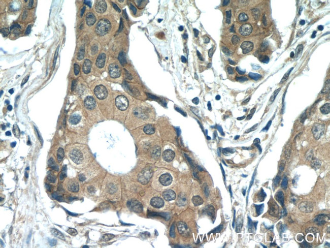 beta-Catenin Antibody in Immunohistochemistry (Paraffin) (IHC (P))